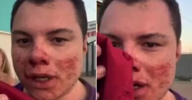 Influenciador está em coma na UTI após ser agredido em festa universitária em São Carlos