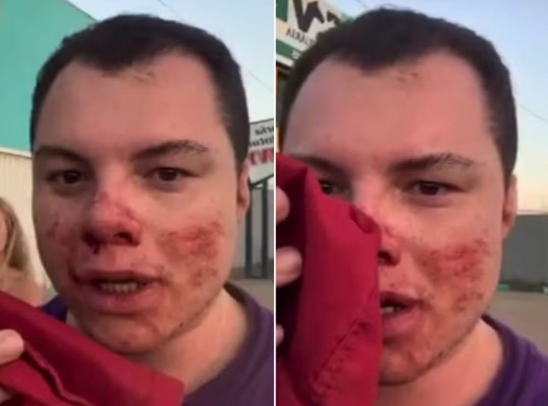 Influenciador está em coma na UTI após ser agredido em festa universitária em São Carlos